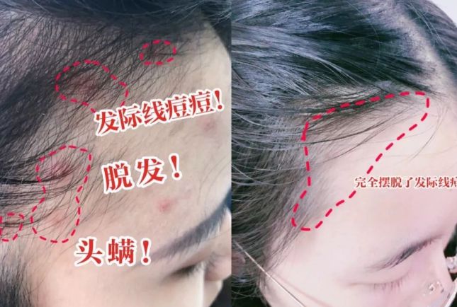 入冬洗头干发神器!养出女明星绸缎发!澳门新葡京app国产变态“抽水帽”(图11) 入冬洗头干发神器!养出女明星绸缎发!澳门新葡京app国产变态“抽水帽”(图11)